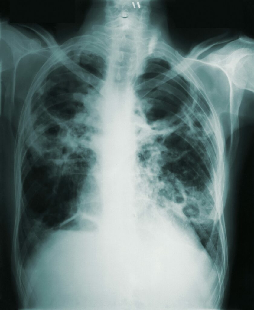X-ray image of human body